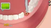Operación del diente